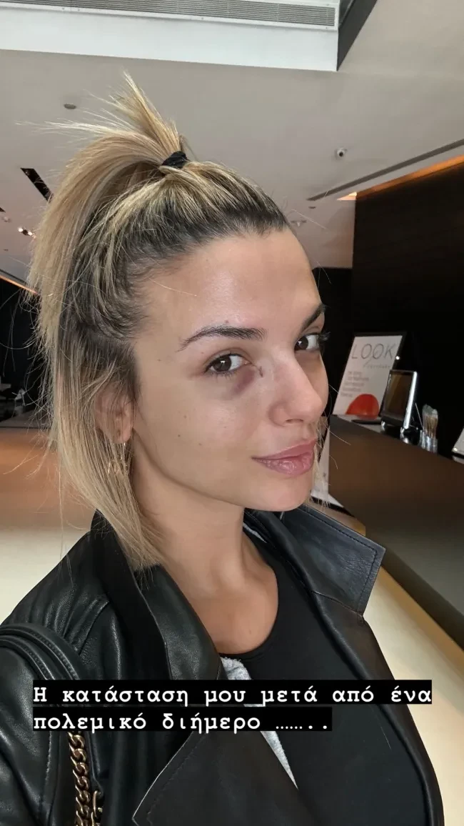 katerina-liolioy-injpg-1.webp