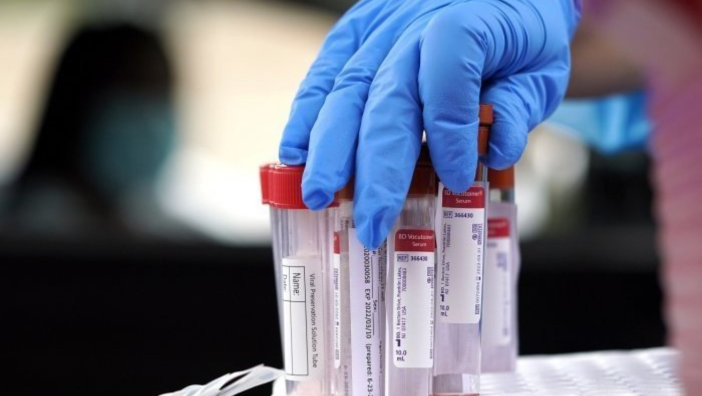 Βατόπουλος : Καμπανάκι για πανηγύρια και ορφανά κρούσματα κορωνοϊού