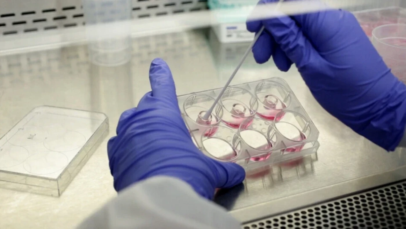 Κορωνοϊός - PCR τεστ: Στα 47 ευρώ πέφτει η ανώτερη τιμή τους