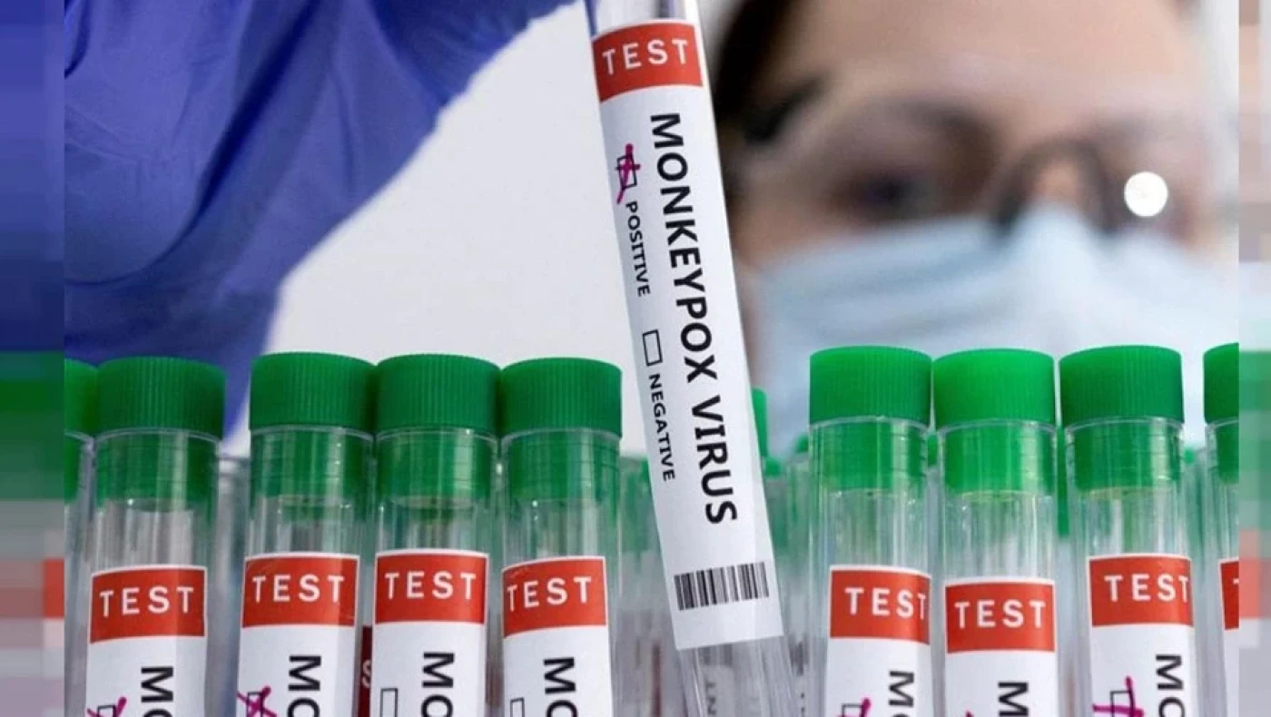 Ευλογιά των πιθήκων: Εμβόλιο ψάχνει η Ευρώπη
